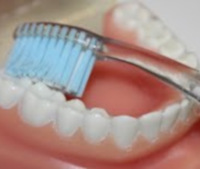 escovagem interior posterior